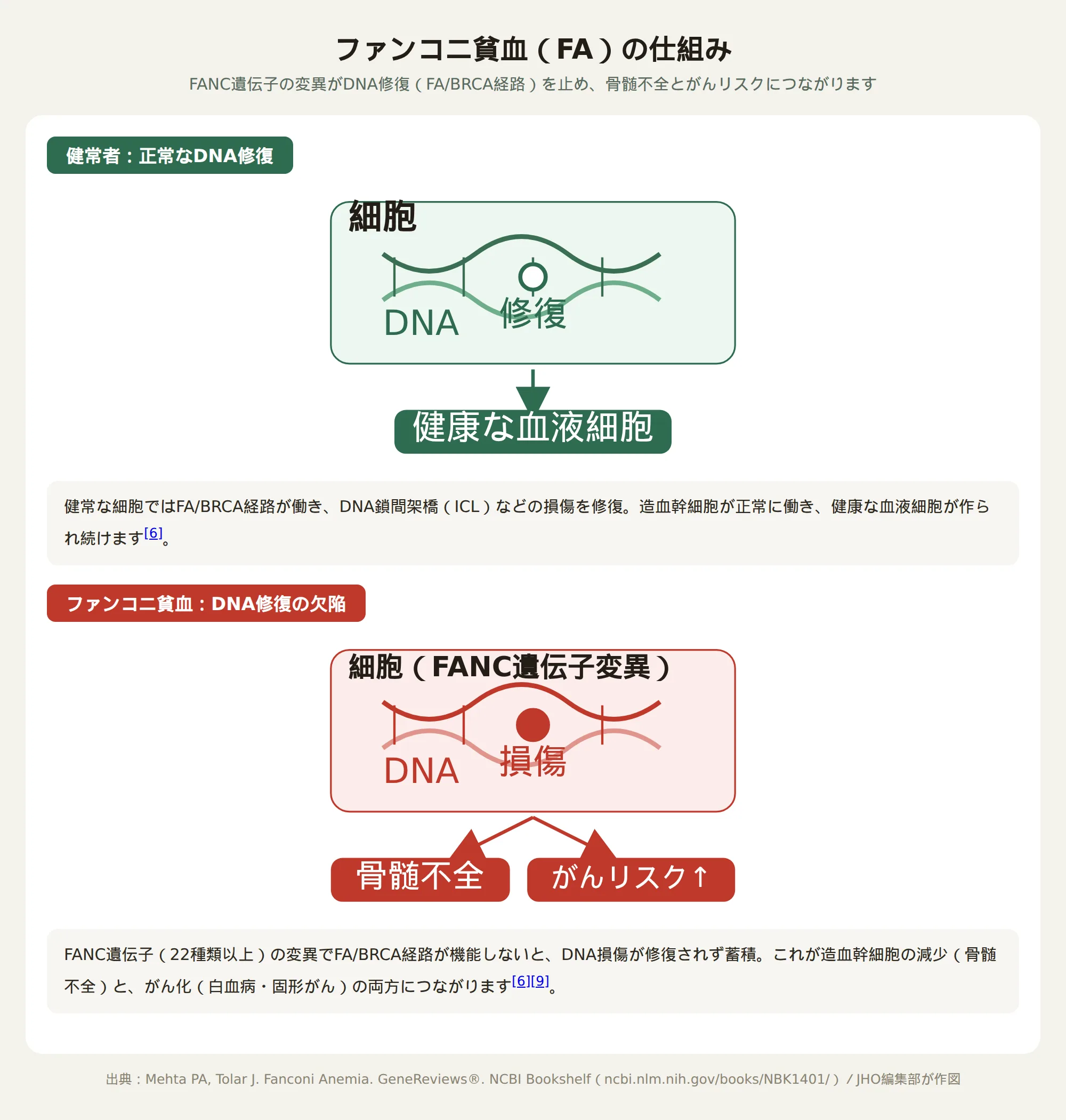 ファンコニ貧血の仕組み：DNA修復の欠陥が骨髄不全とがんリスクにつながる図解