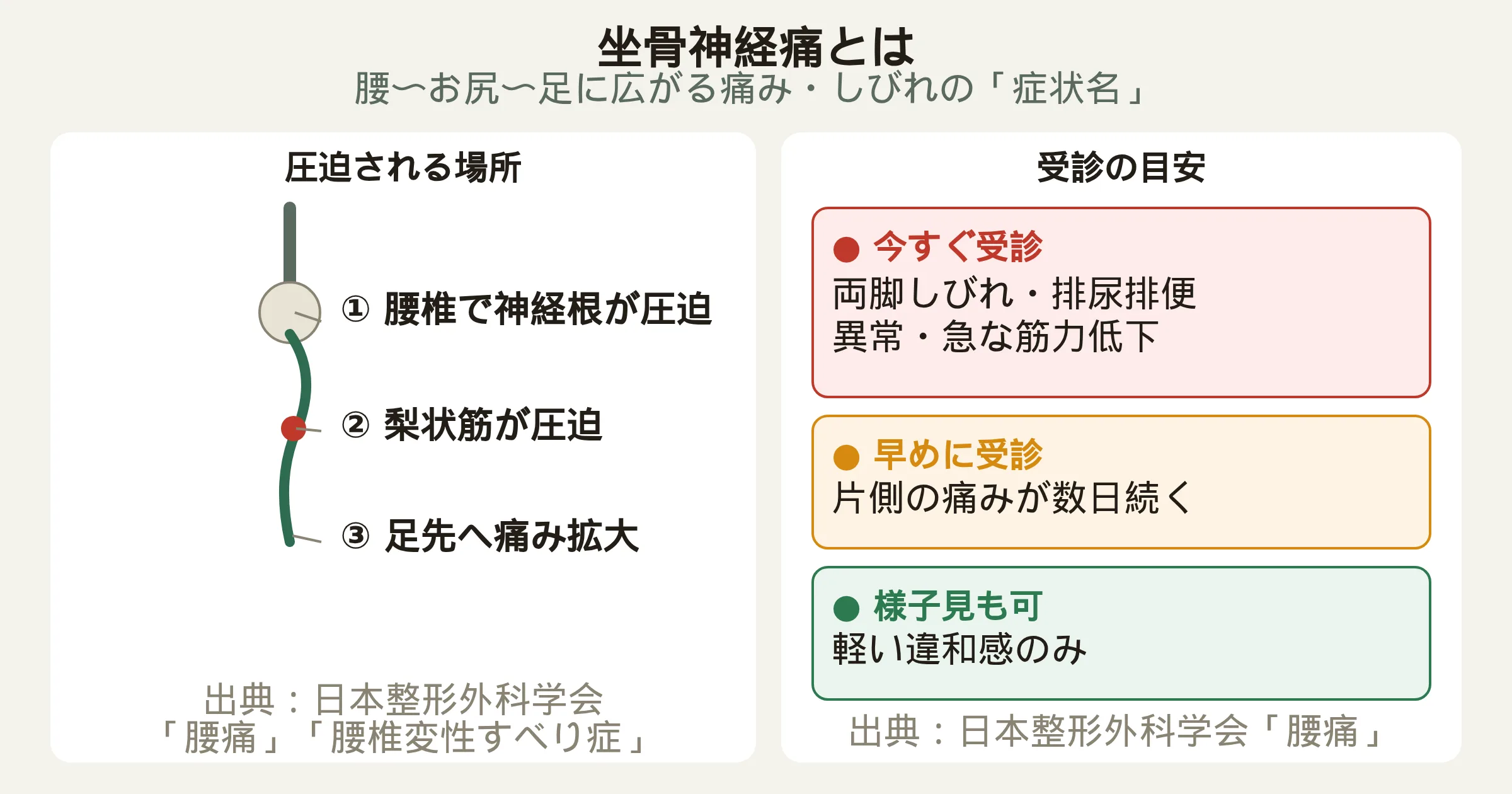 坐骨神経痛とは：坐骨神経が圧迫される場所と受診の目安を示す図