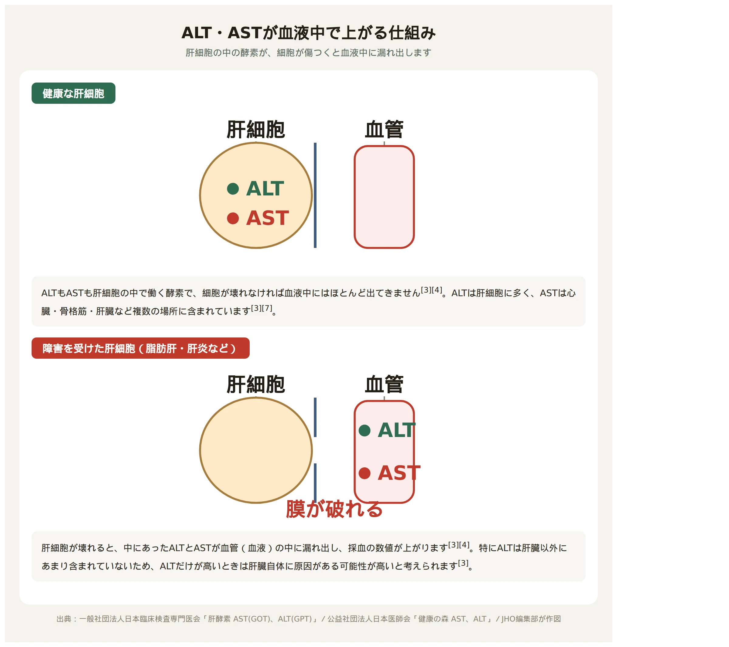 健康な肝細胞ではALT・ASTが細胞の中にとどまり、障害を受けた肝細胞では細胞膜が壊れてALT・ASTが血管の中に漏れ出す仕組みを示す図