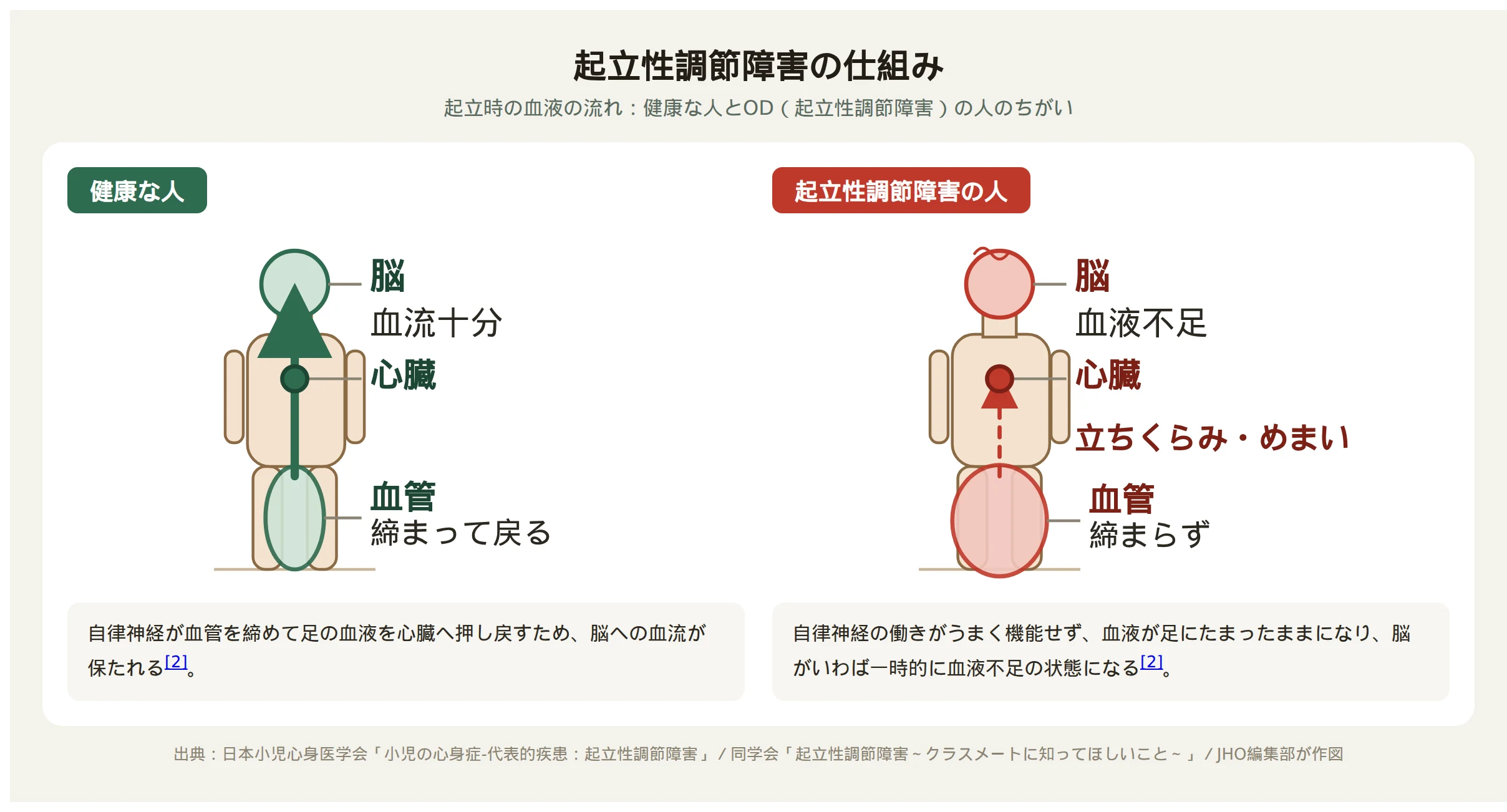 起立性調節障害の仕組み：健康な人は起立時に血管が締まり脳の血流が保たれるが、ODの人は血液が足にとどまり脳が血液不足になる図