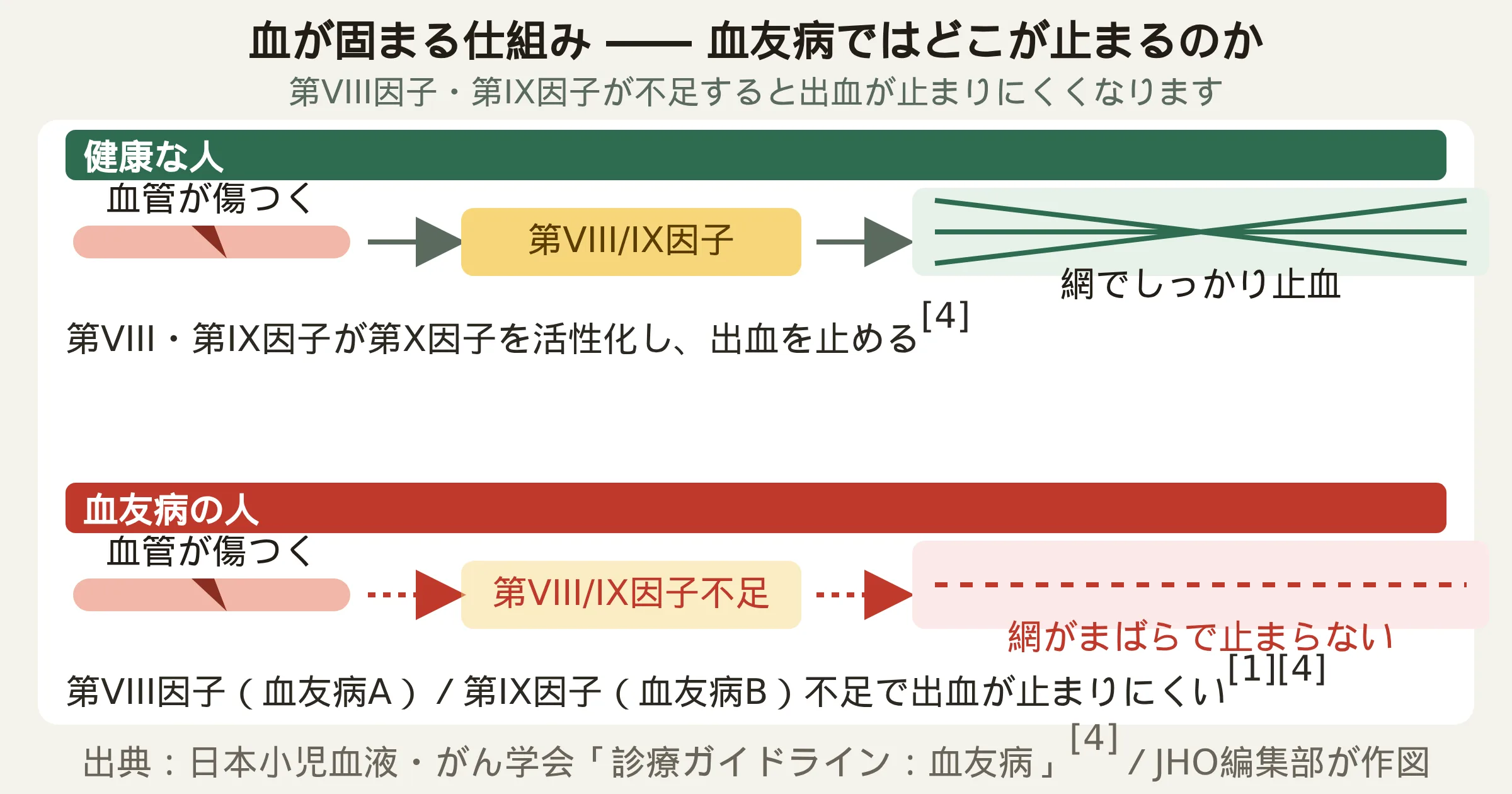 正常な血液凝固の流れ（第VIII因子・第IX因子が働いて血が固まる仕組み）と、血友病で第VIII因子または第IX因子が不足し出血が止まりにくくなる仕組みを比較した図