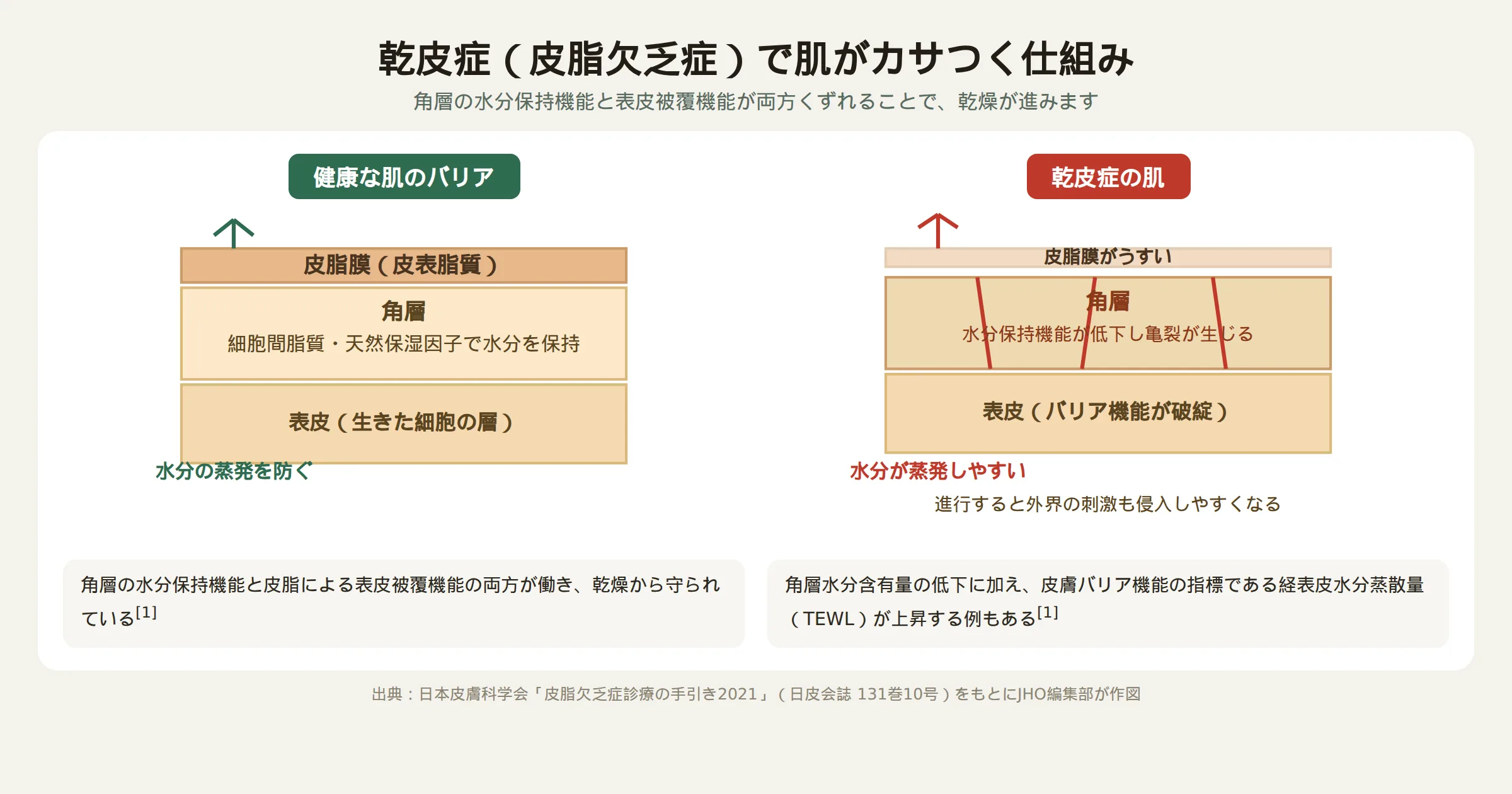 乾皮症で肌がカサつく仕組み：健康な肌と乾皮症の角層バリアの比較図