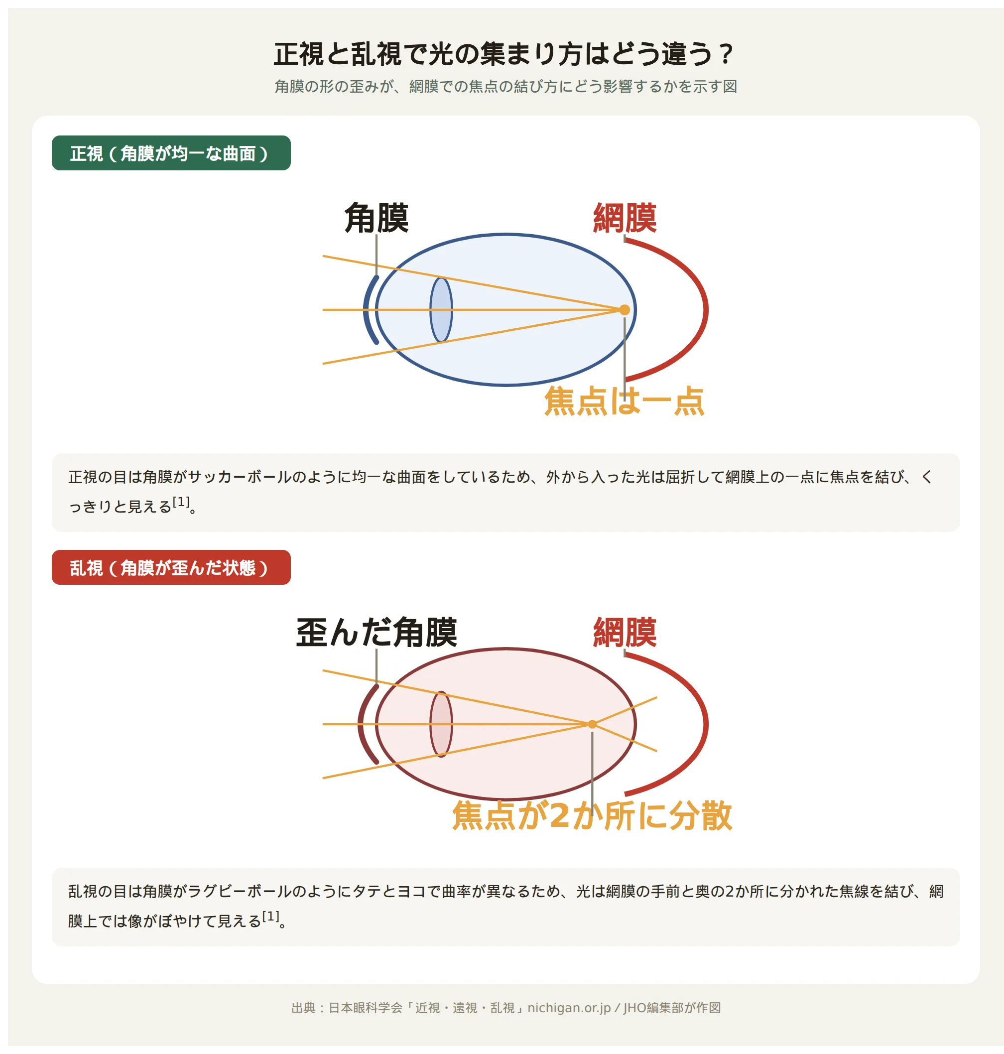 正視と乱視の違いを示す模式図。角膜のゆがみにより光の焦点が網膜上で一致しない仕組みを解説
