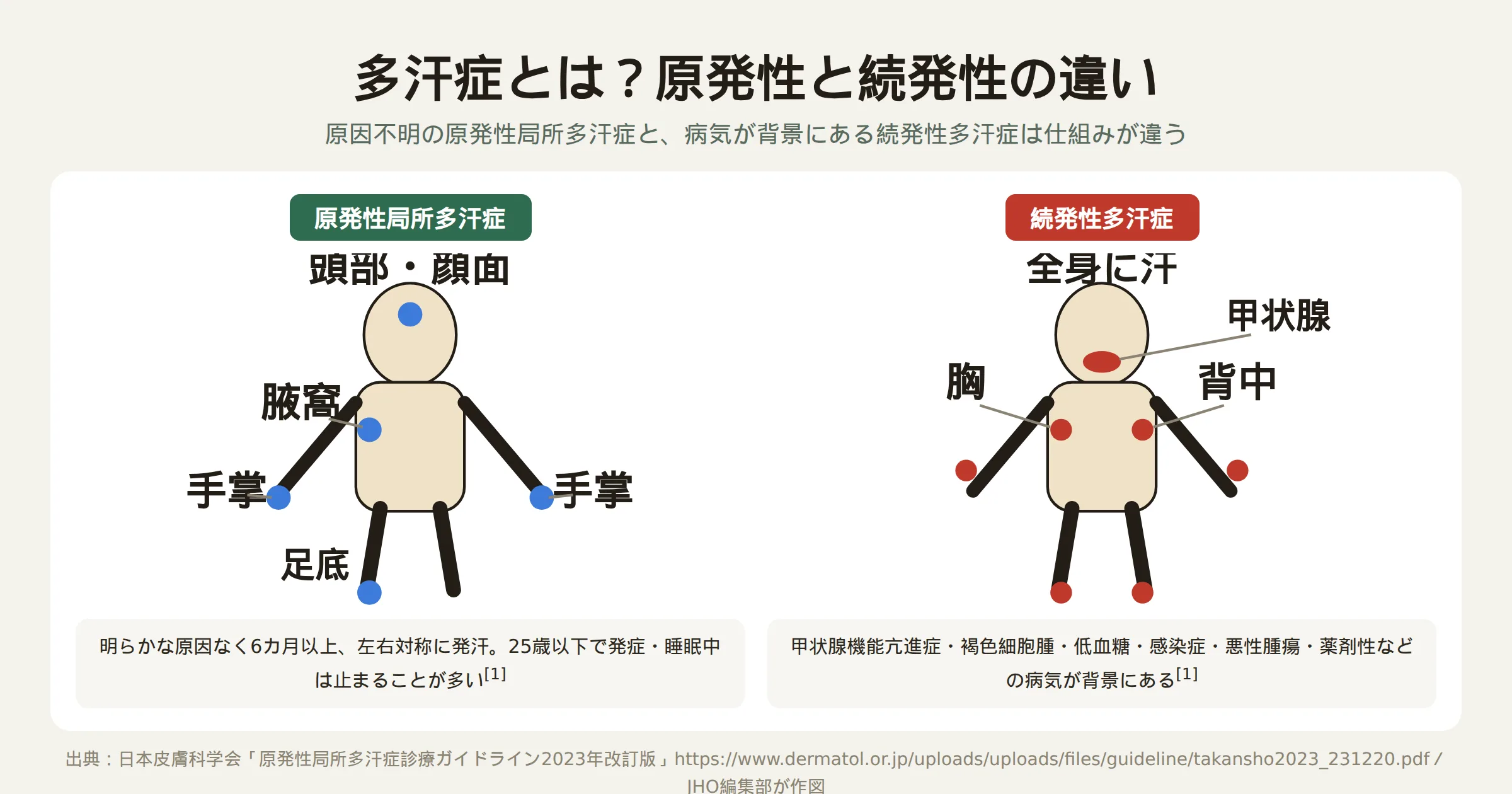多汗症の原発性と続発性を対比した図。健康な状態では体温調節に応じた適量の発汗があり、原発性局所多汗症では手掌・足底・腋窩・頭部顔面に精神的緊張で過剰な発汗が起こる一方、続発性多汗症では甲状腺機能亢進症などの背景疾患により全身性の発汗が起こることを示す