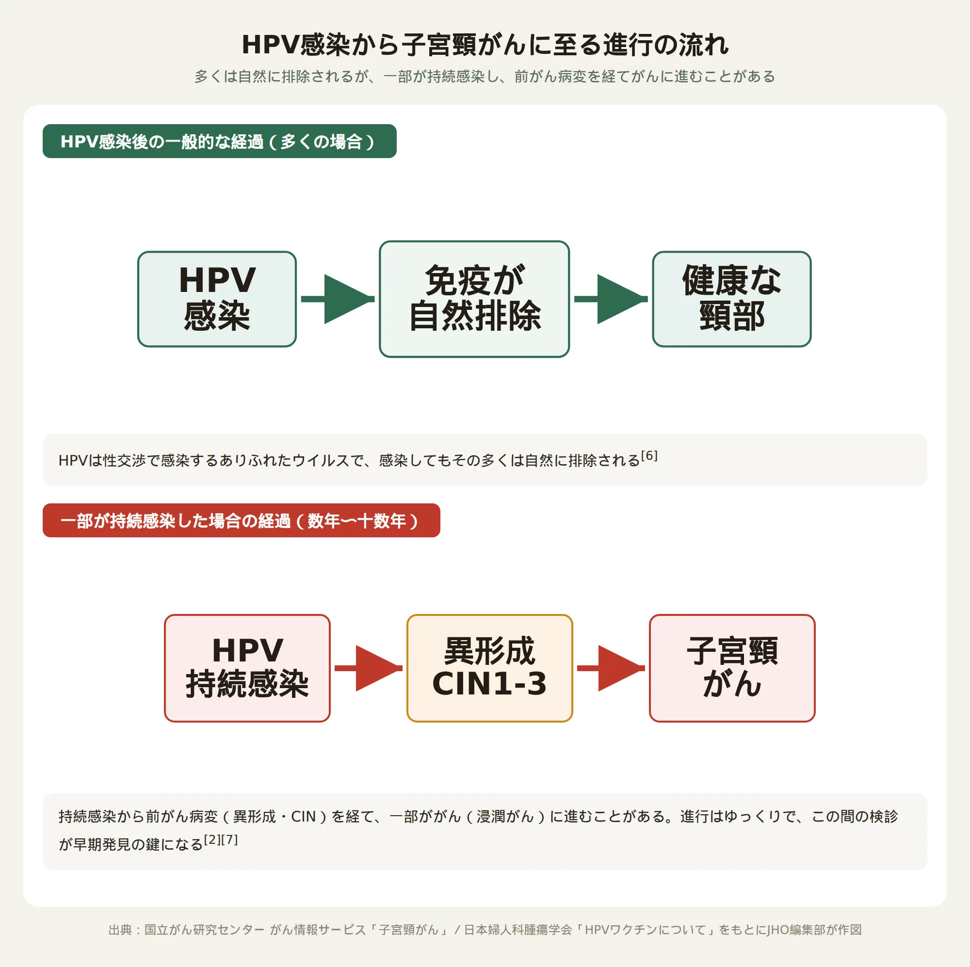 HPV感染から前がん病変（異形成）を経て子宮頸がんに至る進行の仕組みを示した図。多くは自然に排除され、一部が持続感染から前がん病変、さらに一部ががんに進む流れを表す