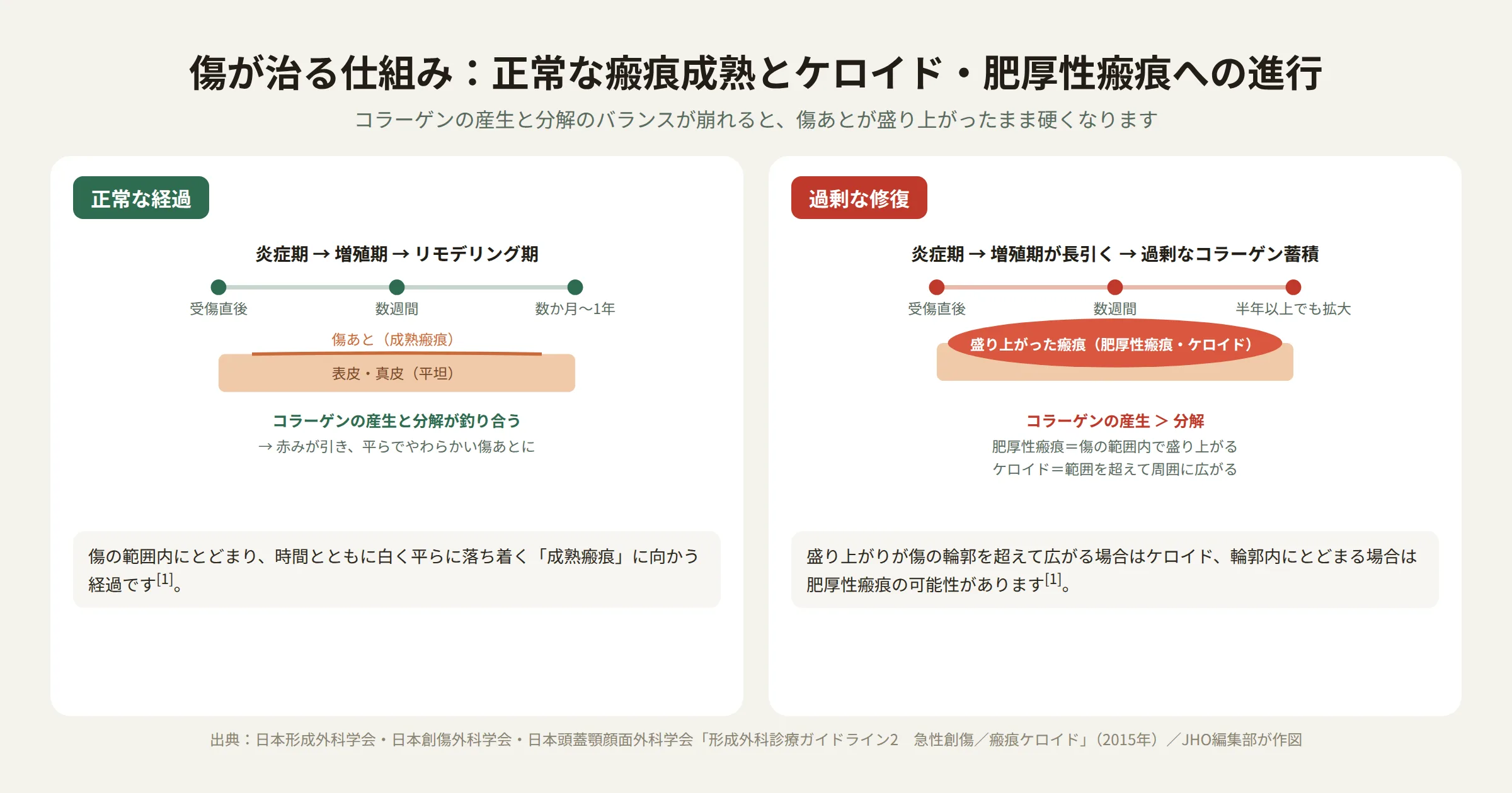 傷が治る仕組み：正常な瘢痕成熟とケロイド・肥厚性瘢痕への進行を示す図解