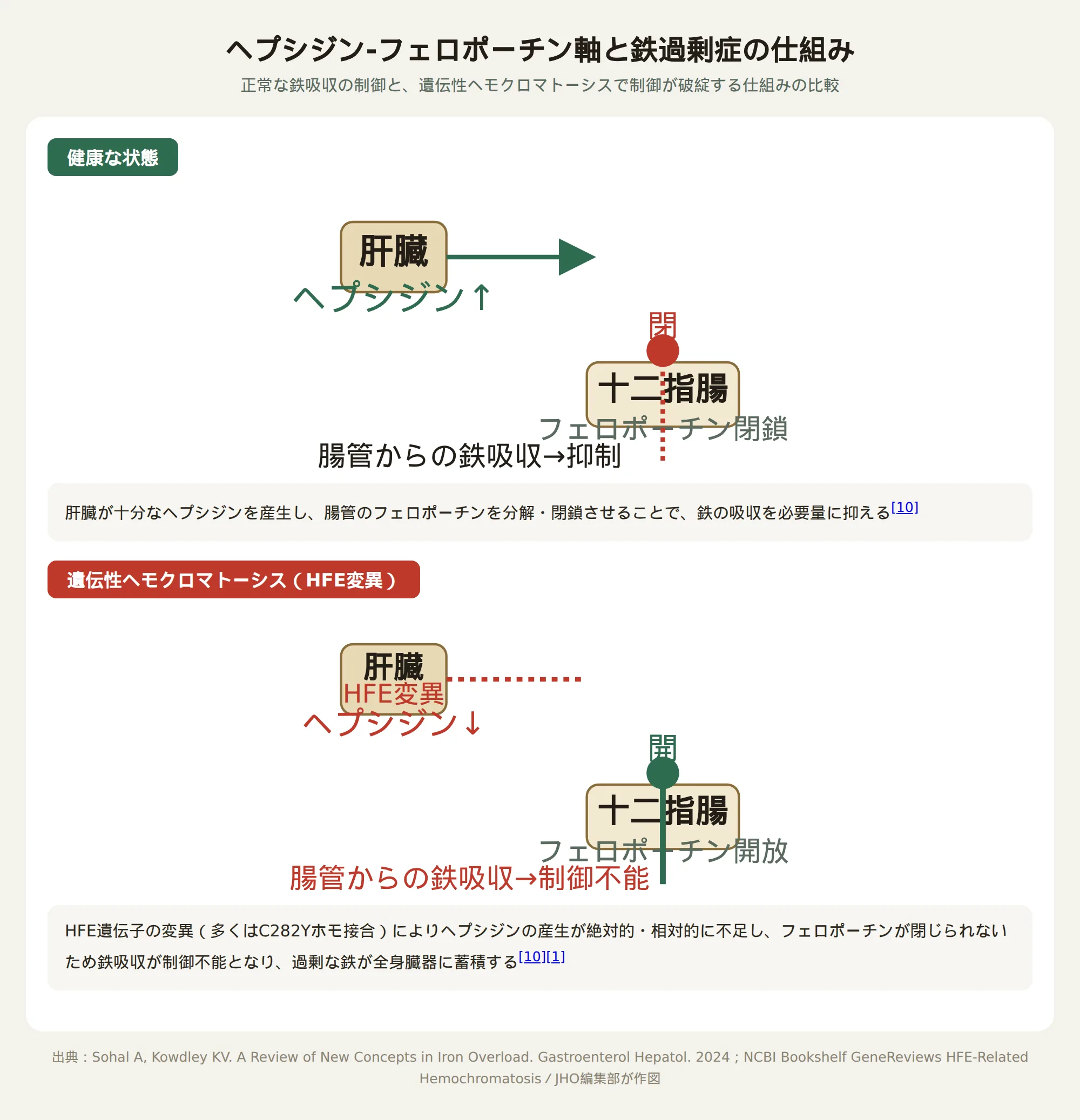 ヘプシジン・フェロポーチン軸のしくみと鉄過剰症
