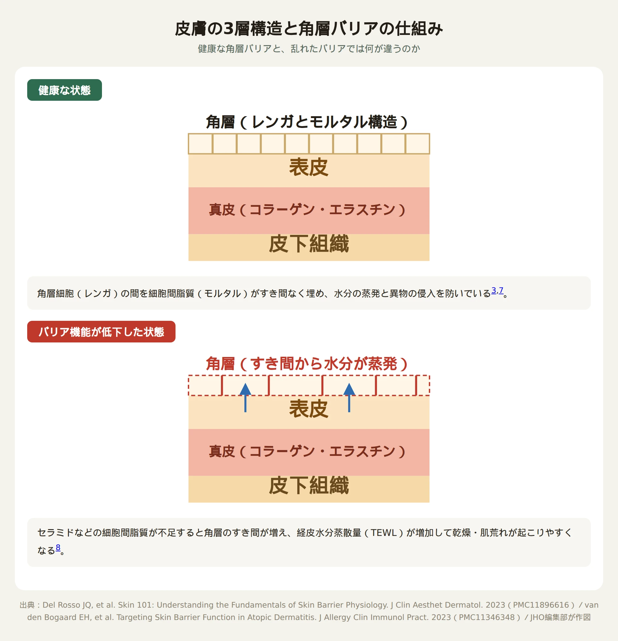 健康な角層バリアと乱れた角層バリアの断面イラスト（角層・表皮・真皮・皮下組織）