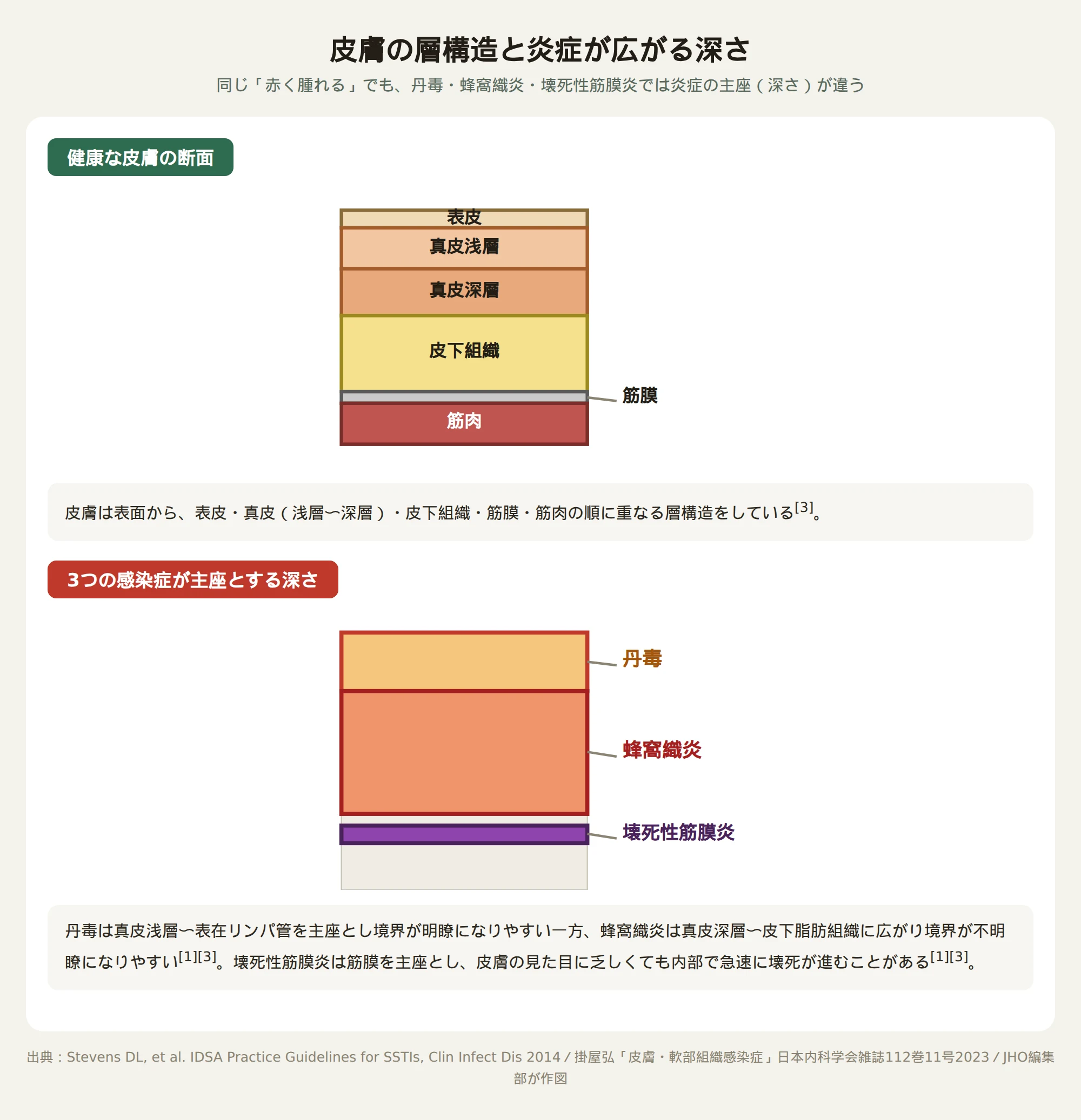 皮膚の断面図。上から表皮・真皮浅層・真皮深層・皮下組織・筋膜・筋肉の順に層が重なっている。下段では同じ層構造に、丹毒は真皮浅層、蜂窩織炎は真皮深層〜皮下組織、壊死性筋膜炎は筋膜の位置を色分けして示している