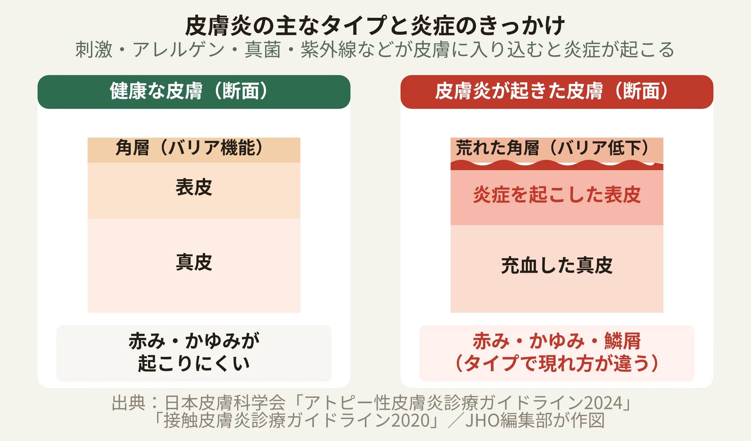 皮膚炎の主なタイプ別に見た炎症が起こる仕組み