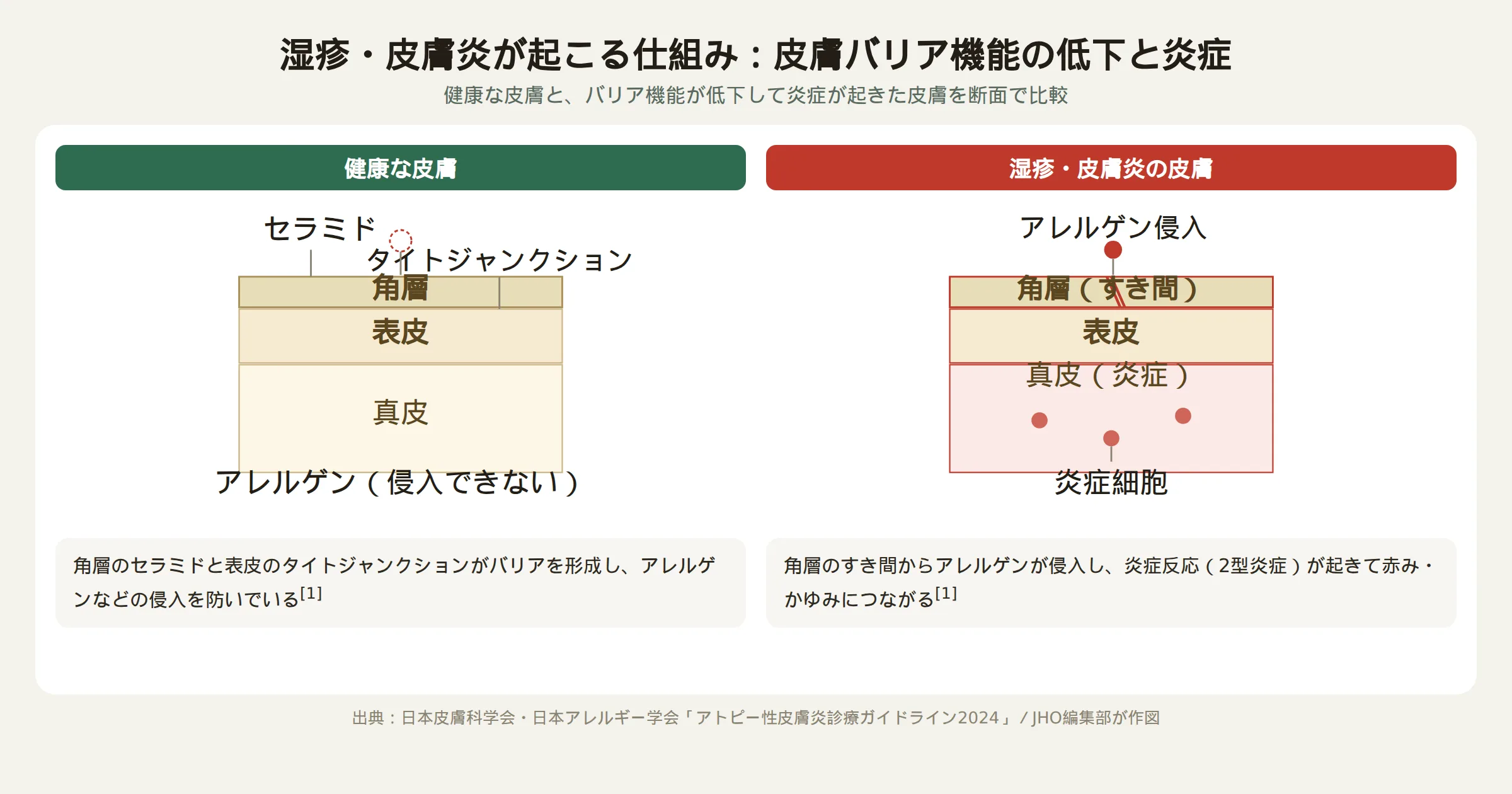 健康な皮膚と湿疹・皮膚炎の皮膚のバリア機能の違いを示す断面図