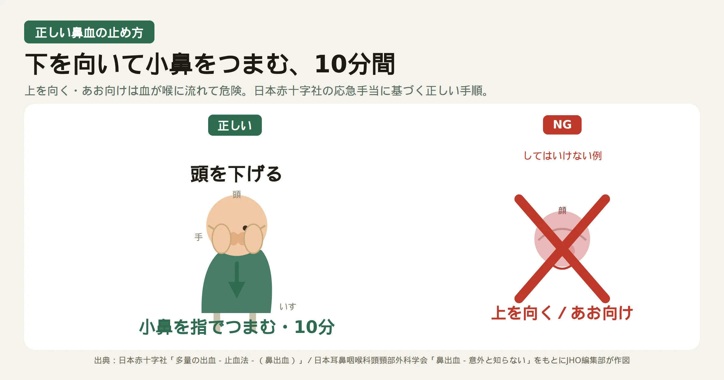 鼻血が出たときの正しい止め方。座って頭を下げ（下を向き）、両手の指で小鼻の柔らかい部分を10分間しっかりつまむ。右側は上を向く・あお向けになるNG例で、血液が喉に流れて危険なため誤り。