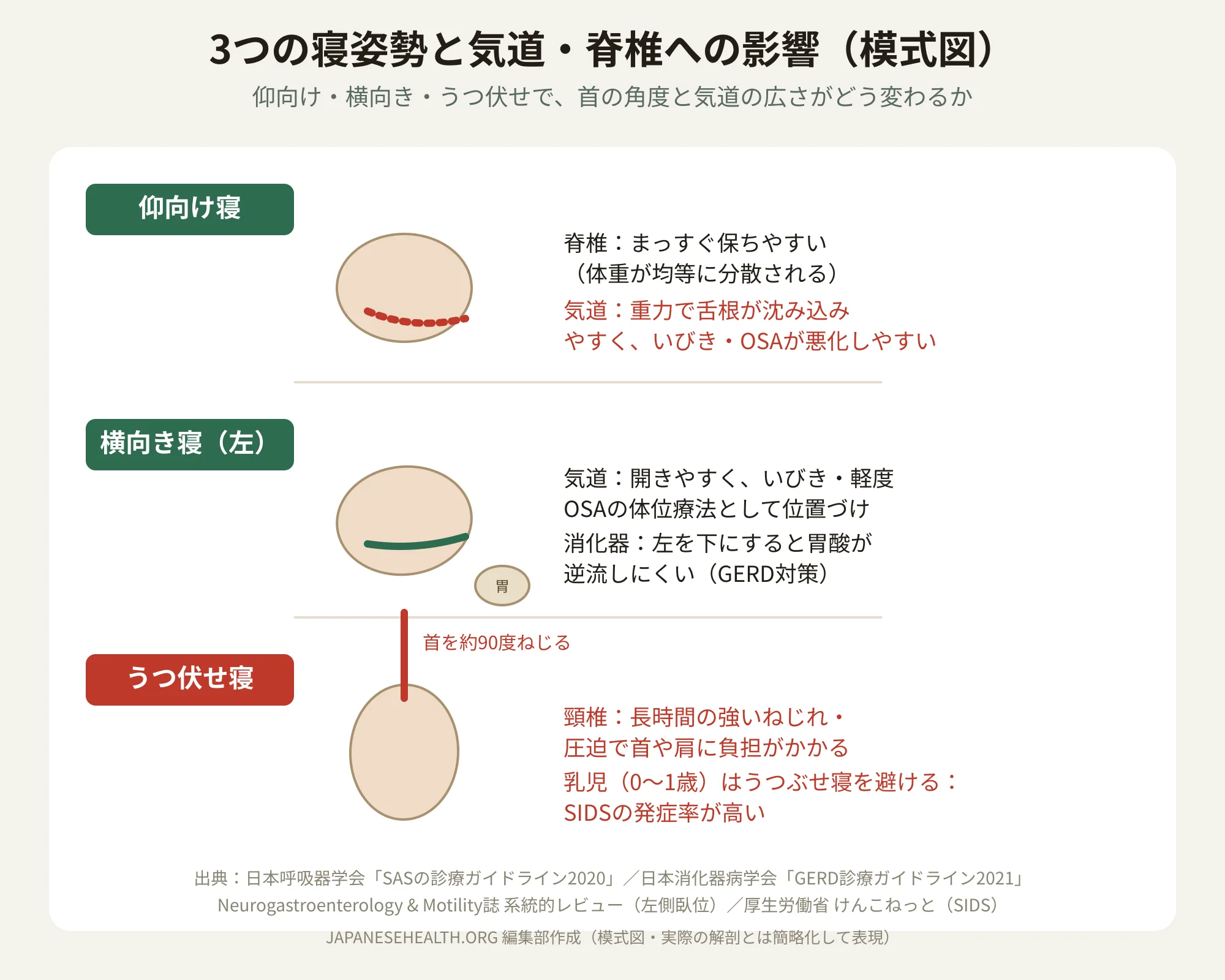 仰向け寝・横向き寝・うつ伏せ寝で気道と脊椎への影響がどう変わるかを示す模式図