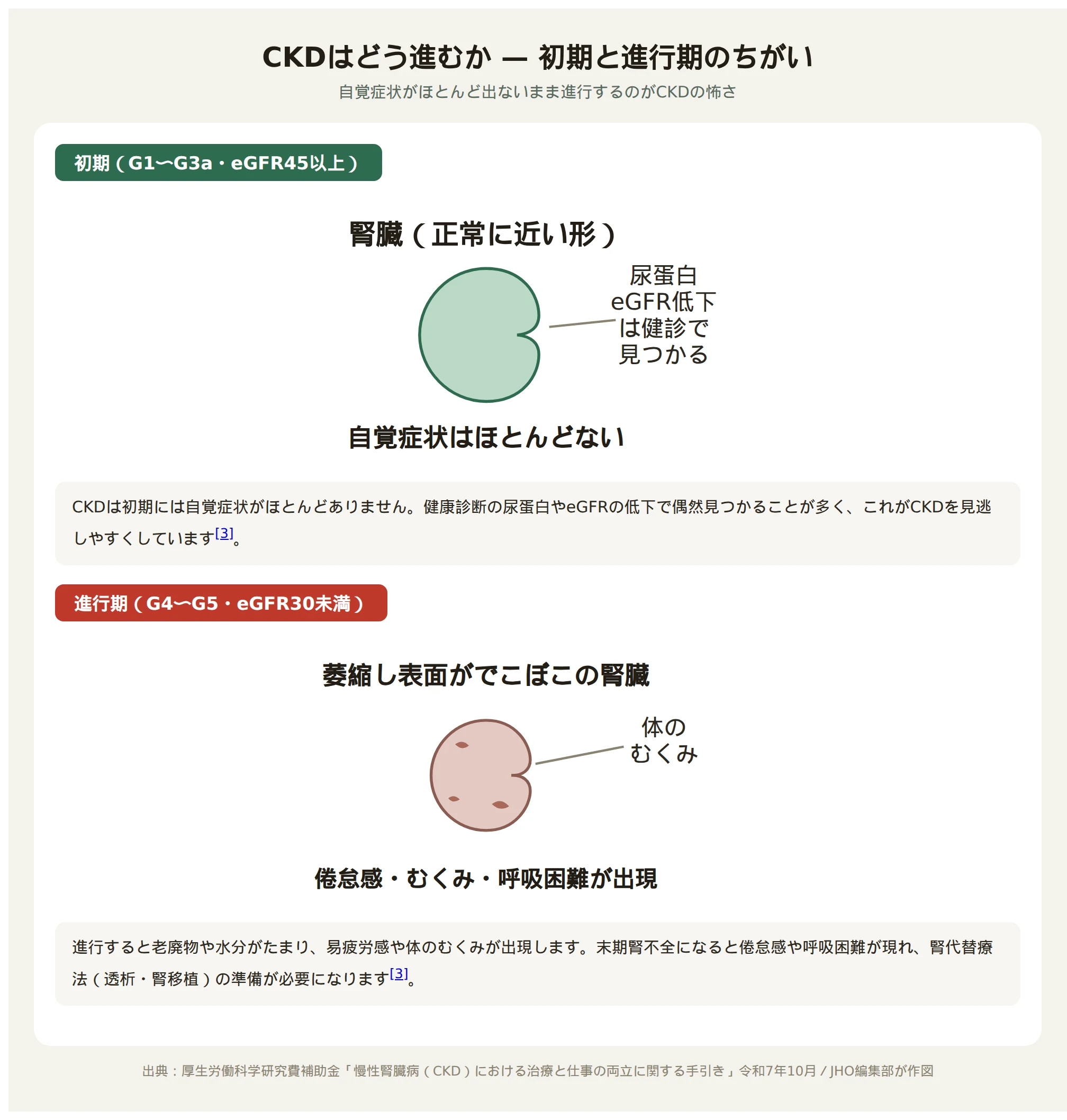 CKDの進行を示す図。初期（G1〜G3a、eGFR45以上）は腎臓の形がほぼ正常で自覚症状がほとんどないのに対し、進行期（G4〜G5、eGFR30未満）は腎臓が萎縮し表面がでこぼこになり、倦怠感やむくみ、呼吸困難が出現する