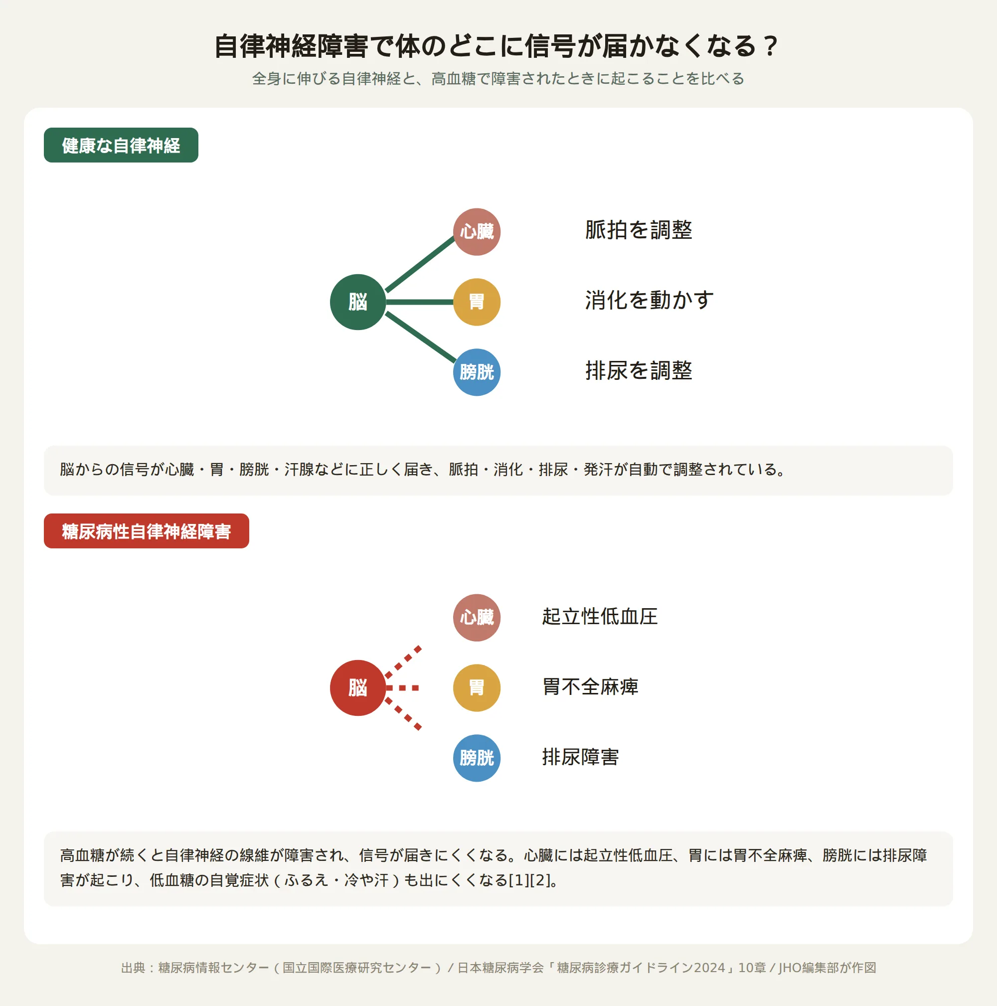 健康な自律神経と糖尿病性自律神経障害で心臓・胃・膀胱への信号が届かなくなる様子を示す模式図