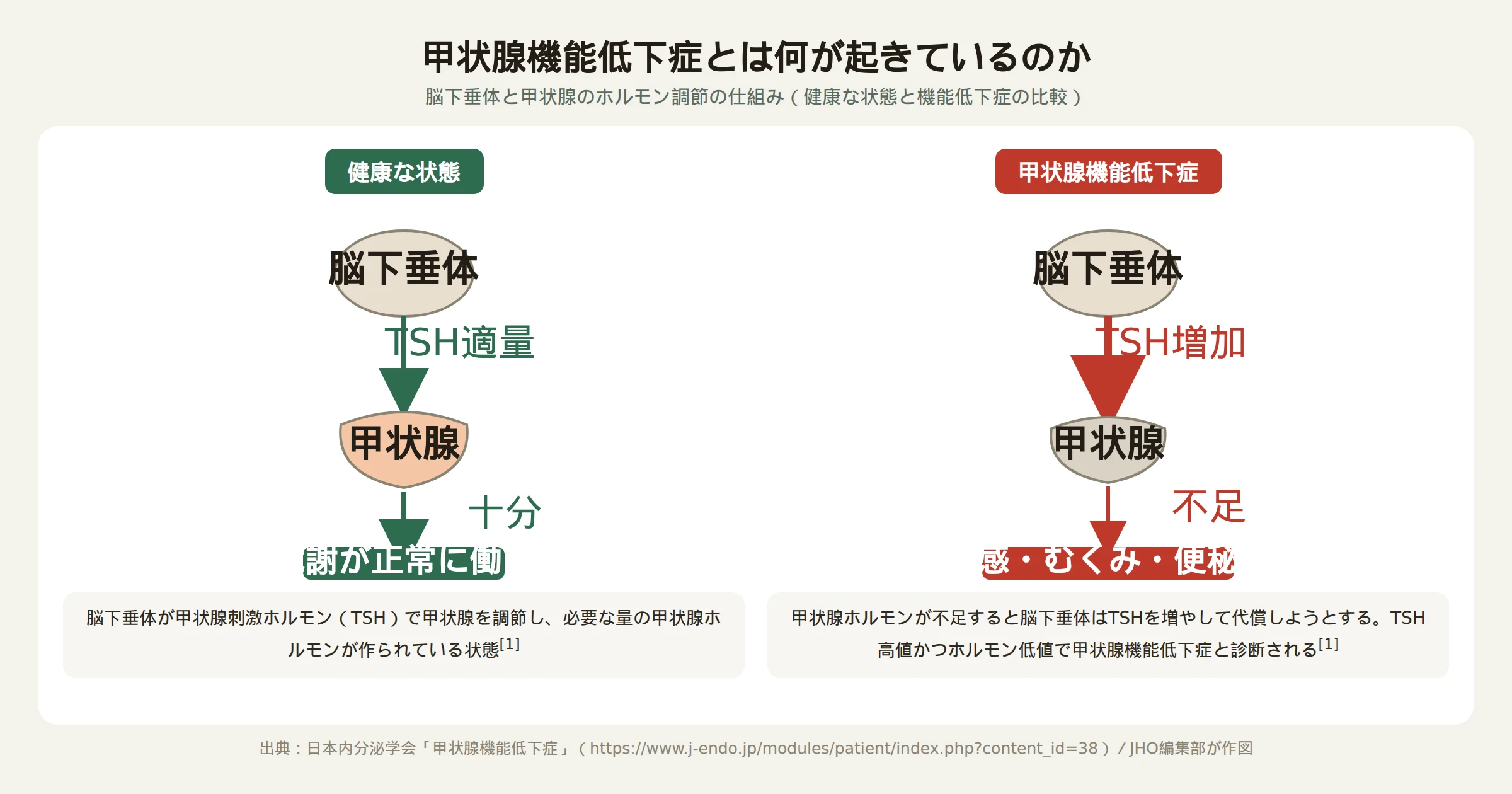 甲状腺機能低下症とは何が起きているのか、脳下垂体と甲状腺のしくみを描いた図解