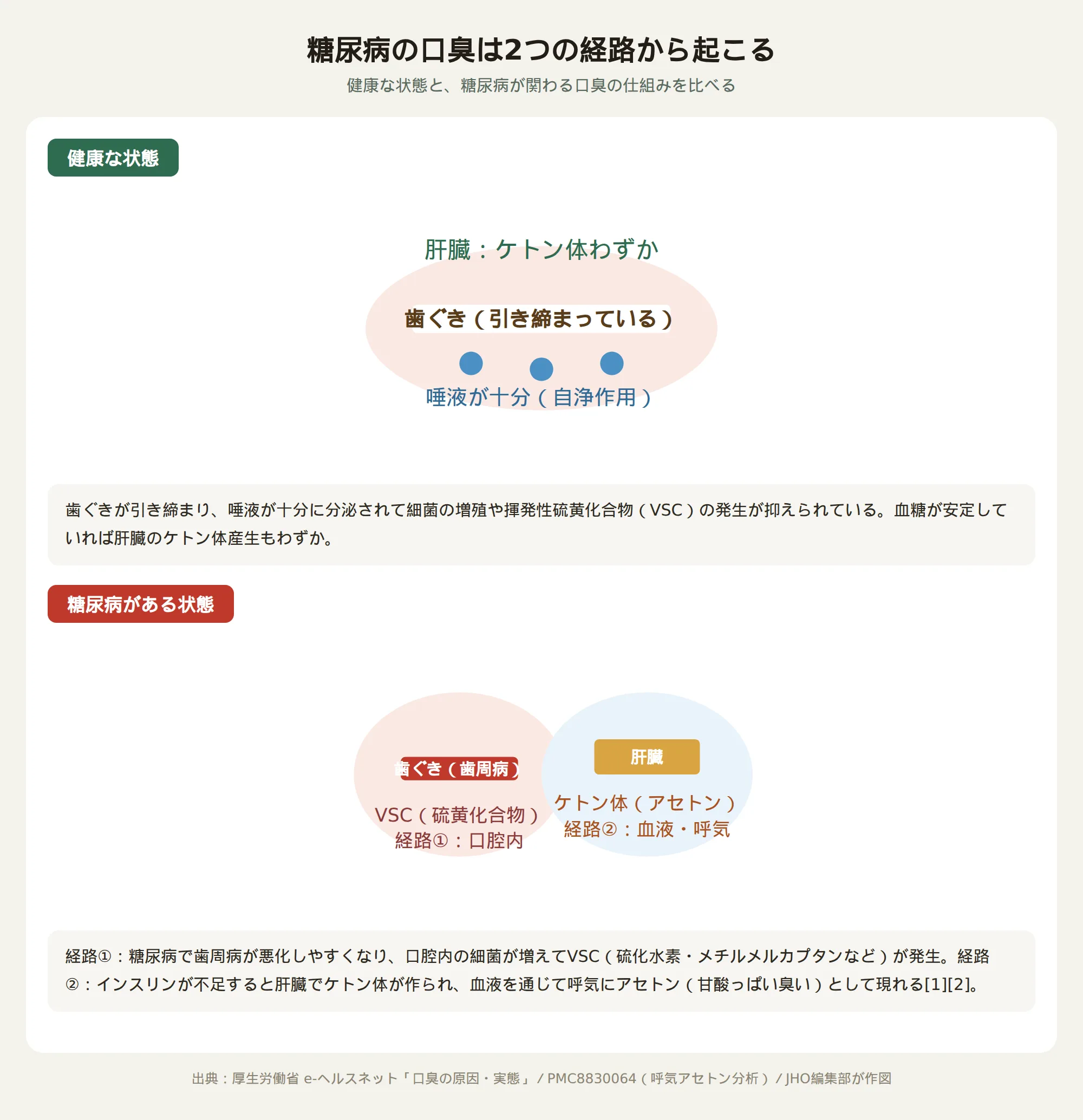 健康な状態と糖尿病がある状態で口臭が発生する2つの経路（歯周病由来のVSCと肝臓由来のケトン臭）を示す模式図