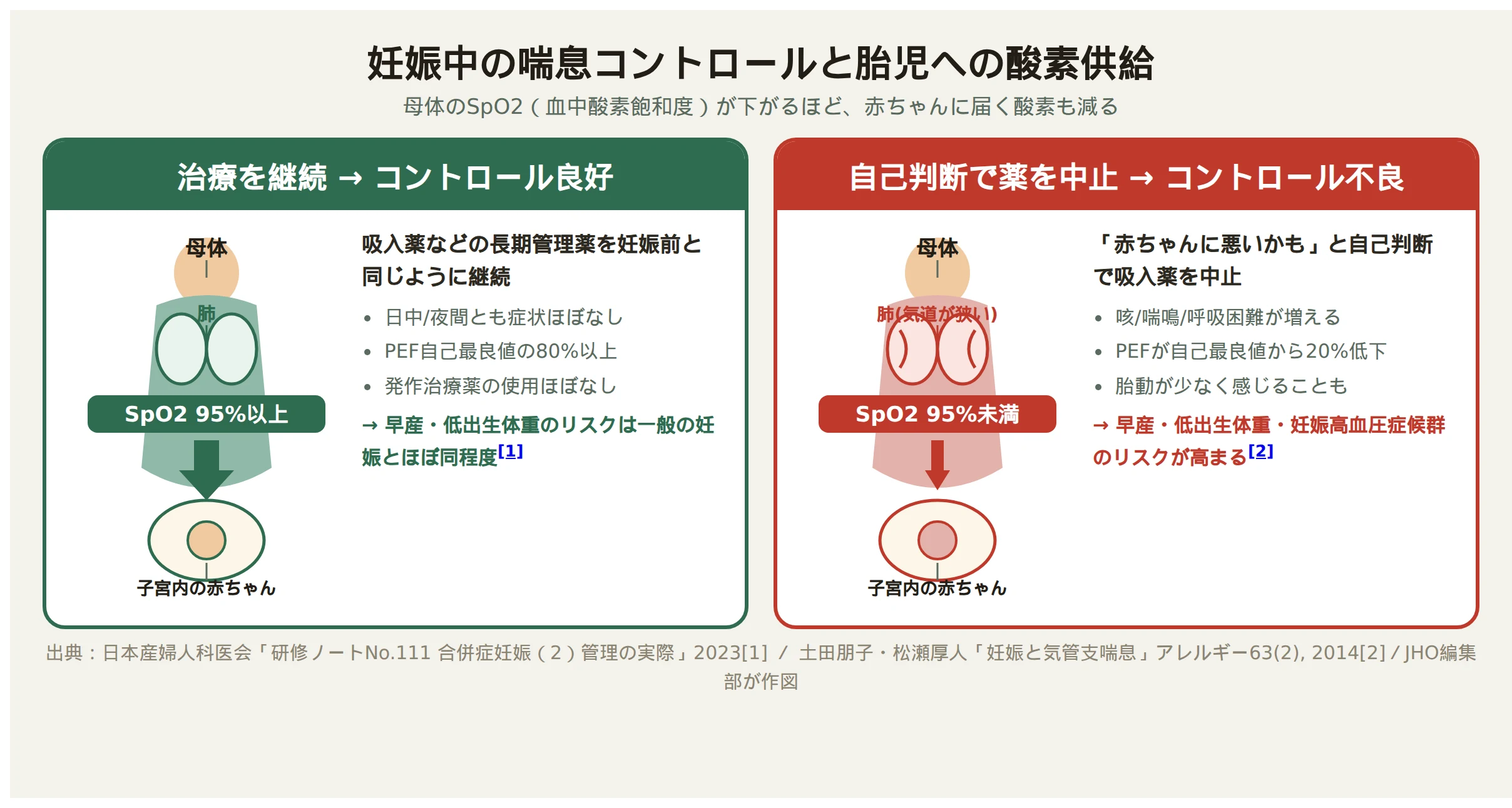 妊娠中の喘息、治療継続時と自己判断で中止した時で母体の血中酸素飽和度と胎児への酸素供給がどう変わるかを示した図