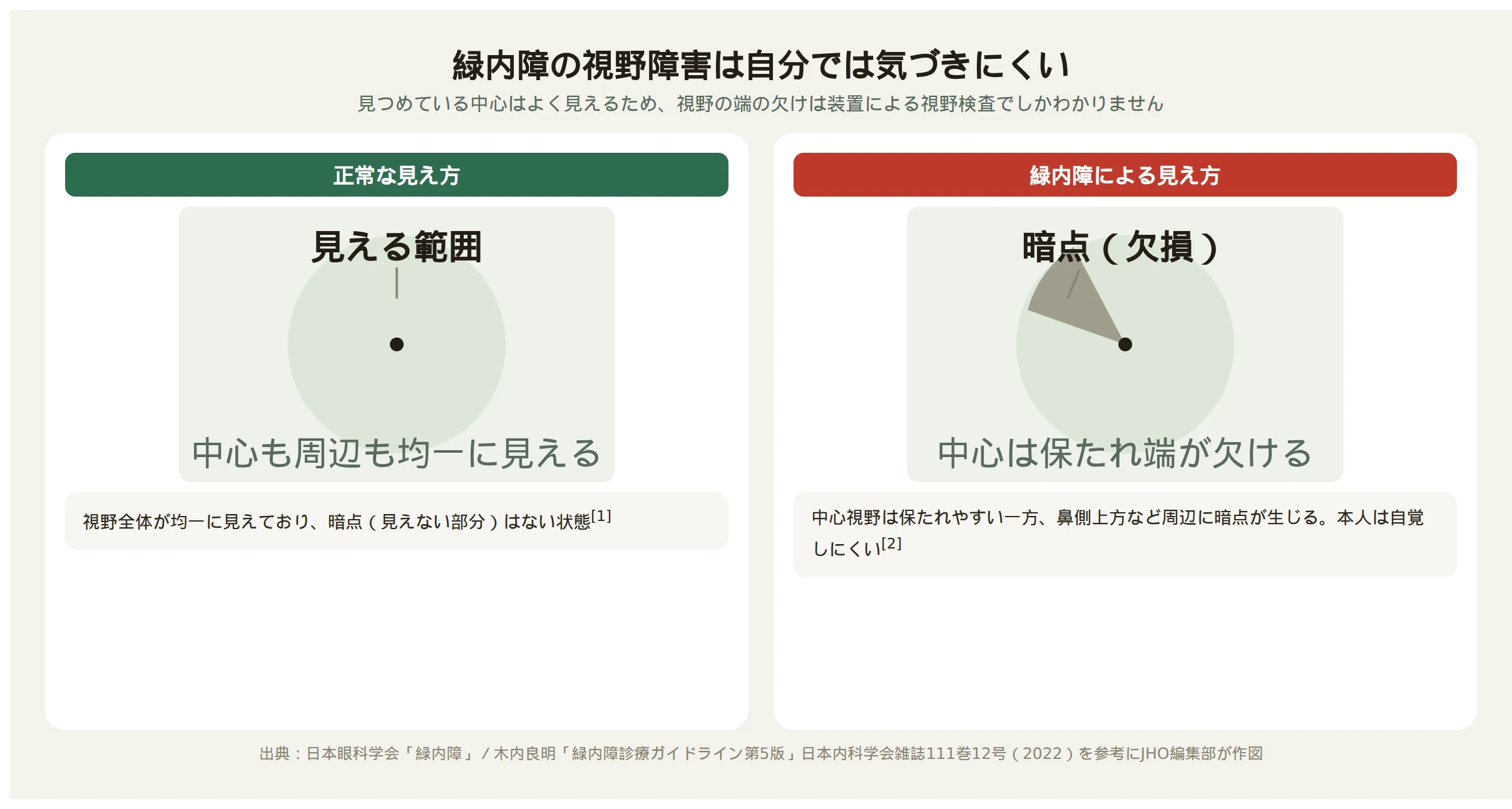 正常な見え方と緑内障で鼻側上方に暗点が生じた見え方のイメージ図