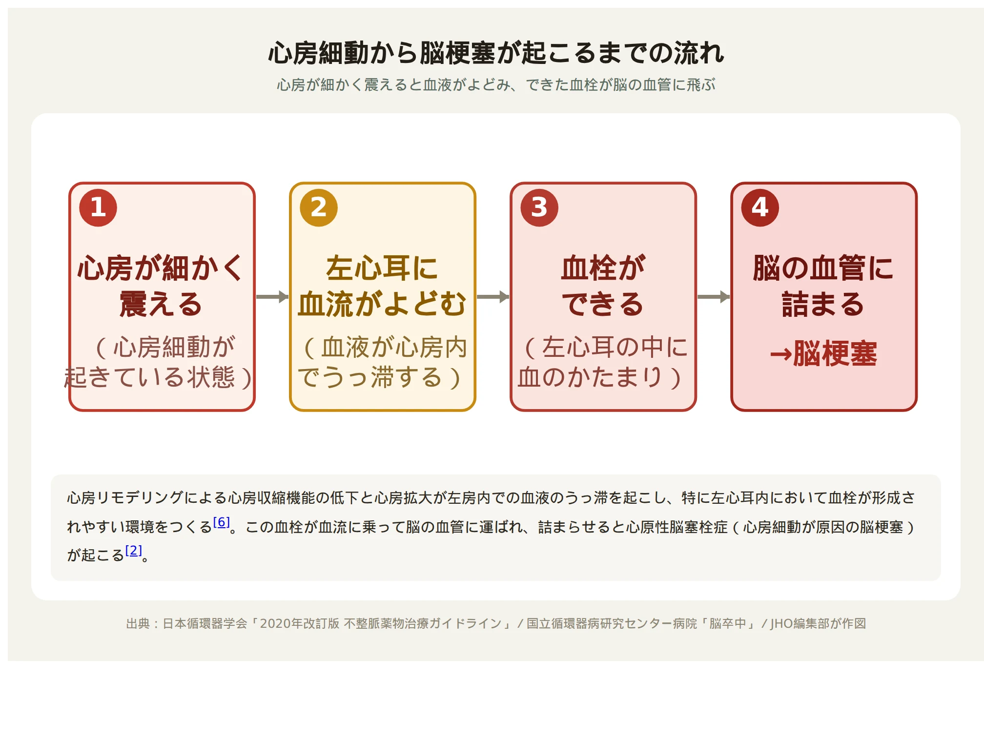 心房細動で左心耳に血栓ができ脳の血管に詰まるまでの流れを示した図