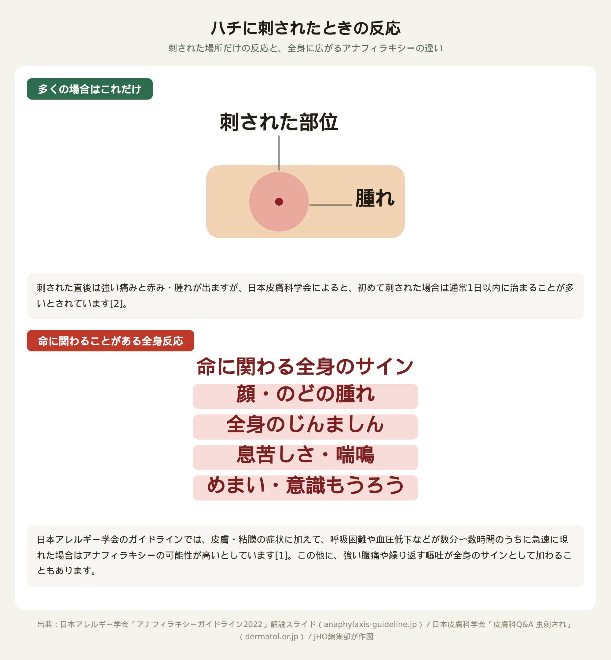 ハチに刺されたときの局所反応とアナフィラキシー全身反応の比較図