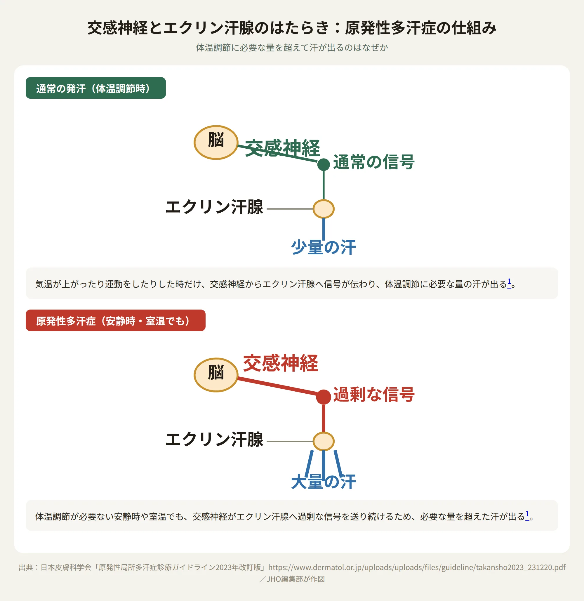 交感神経とエクリン汗腺のはたらき：通常は体温調節が必要な時だけ信号が伝わり少量の汗が出るが、原発性多汗症では安静時でも交感神経が過剰な信号を送り続け大量の汗が出る仕組みを示す図