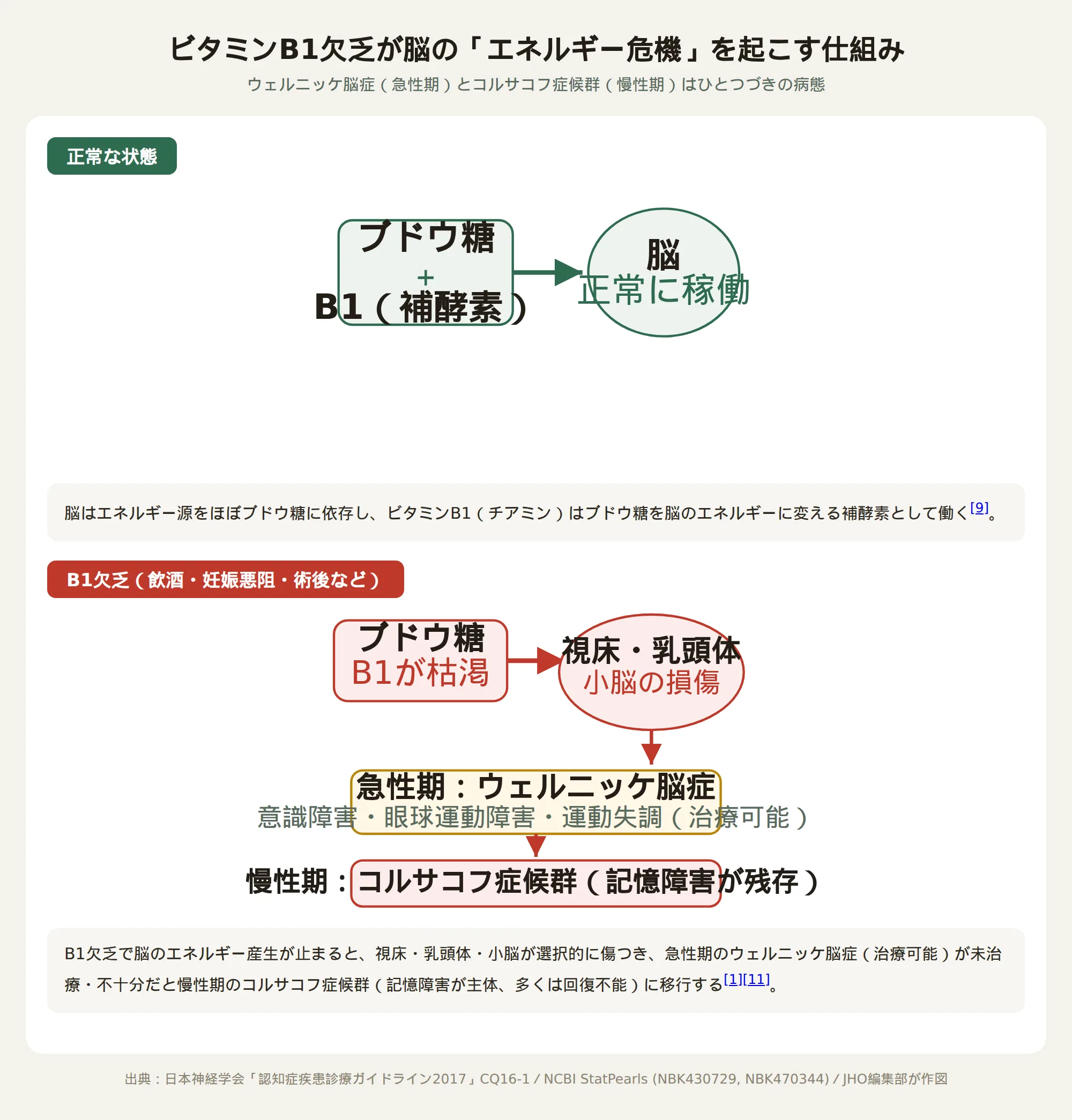 ビタミンB1欠乏が脳のエネルギー危機を起こし、急性期のウェルニッケ脳症から慢性期のコルサコフ症候群に至る仕組みを示す図
