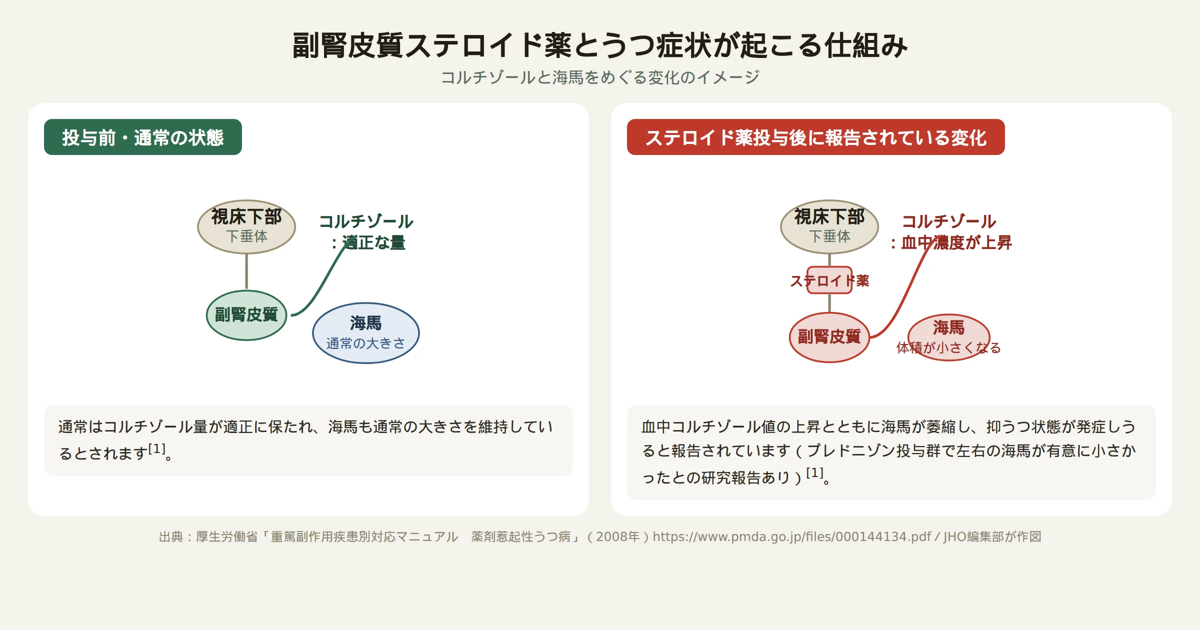 副腎皮質ステロイド薬が投与前後で海馬とコルチゾールに与える影響を示す模式図