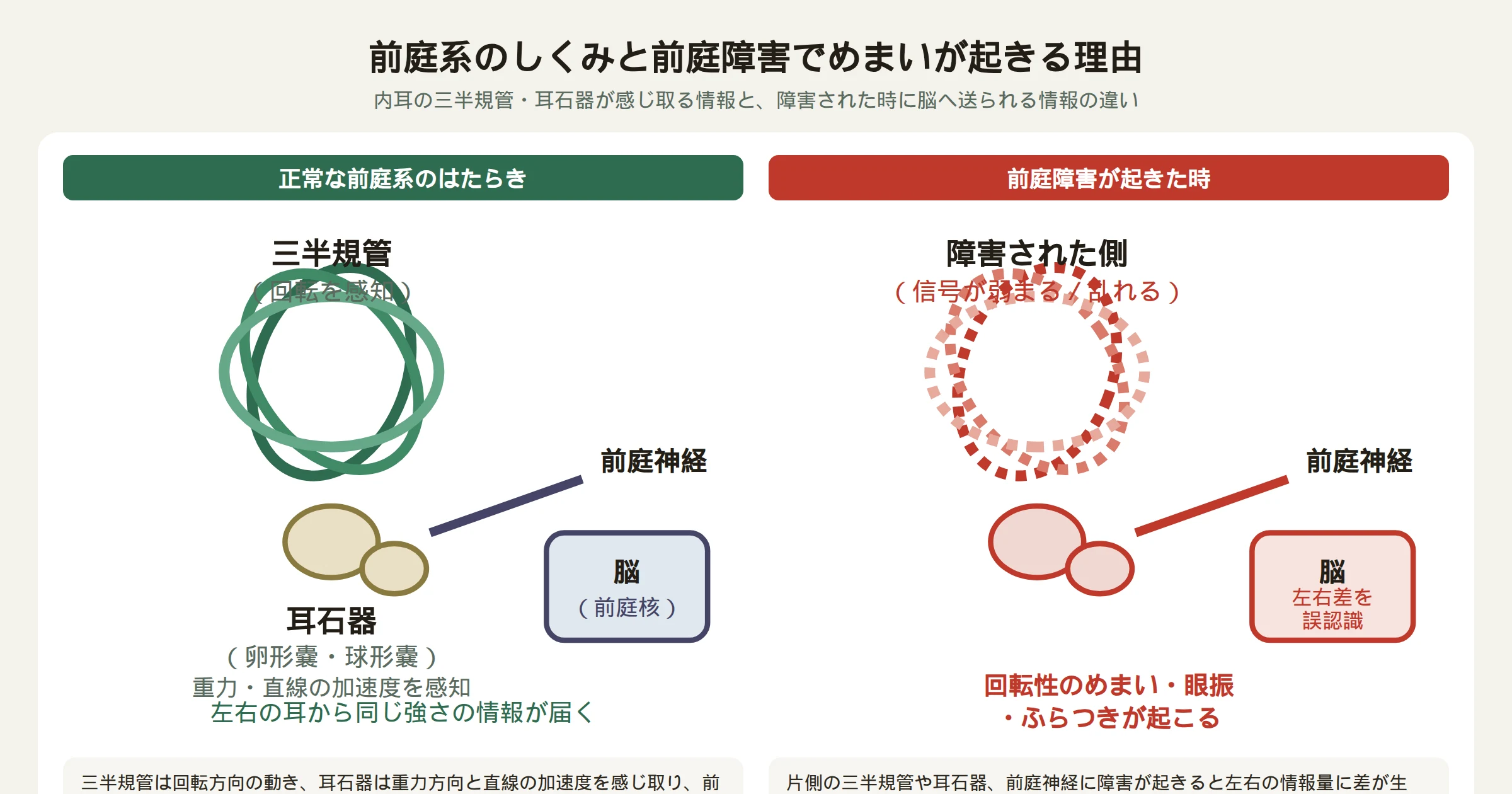 前庭系のしくみと前庭障害でめまいが起きる理由を示す図