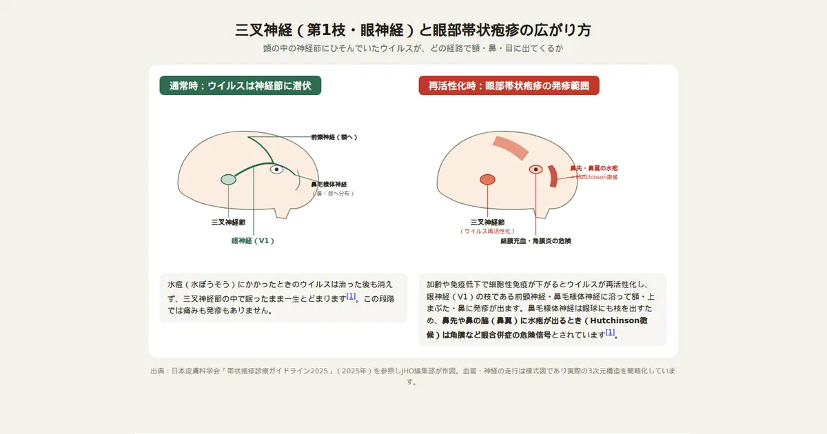 三叉神経第1枝（眼神経）の走行と眼部帯状疱疹の発疹が出やすい部位を示す図
