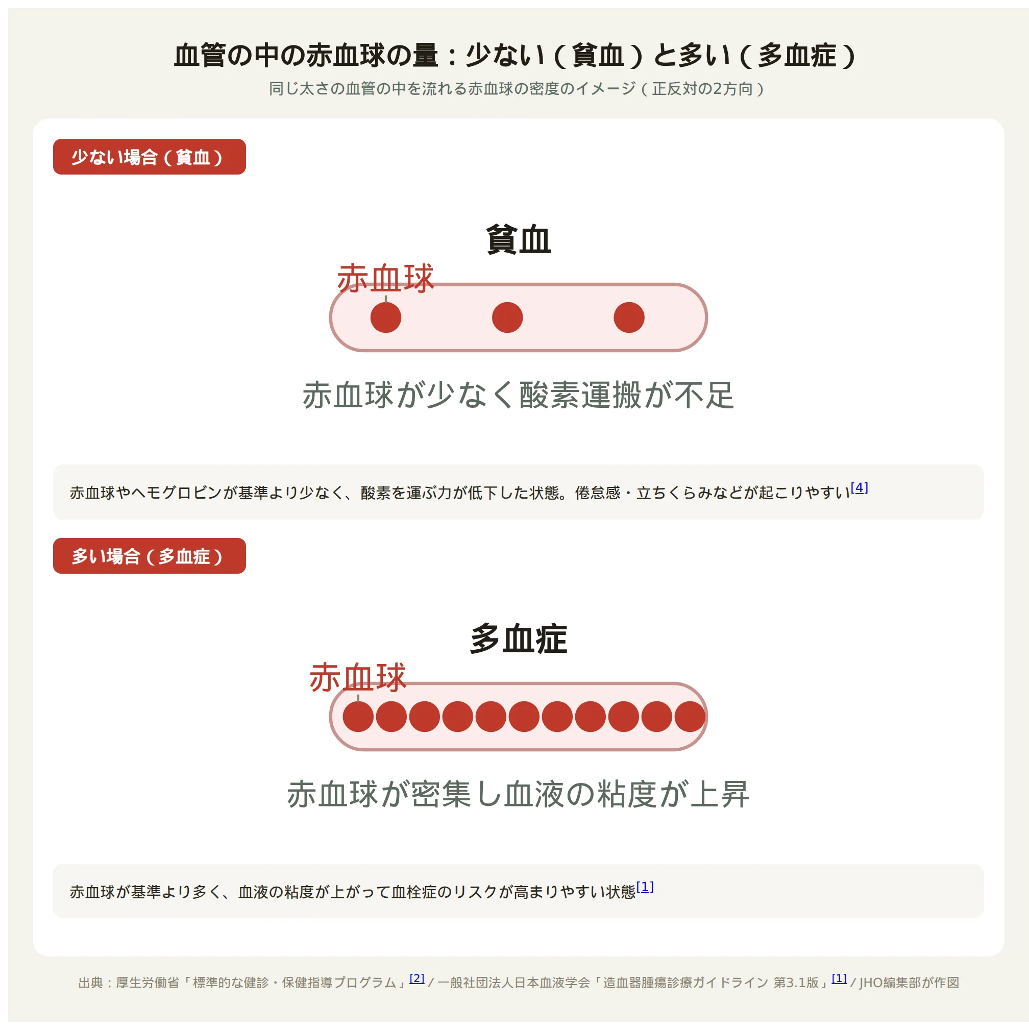 血管内の赤血球の密度を示す図。貧血は赤血球がまばら、多血症は密集している
