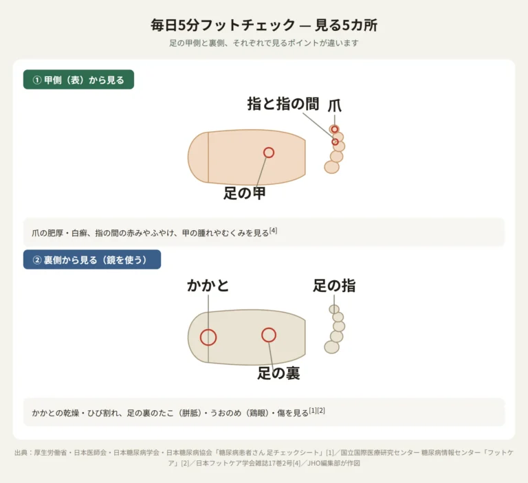 糖尿病 完全ガイド|症状・診断・治療・合併症・食事療法・運動・予防 8 糖尿病フットケア 毎日5分チェックする5カ所(指の間・爪・足の甲・かかと・足の裏)
